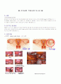 case(ovarian cystic) 1페이지