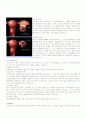 case(ovarian cystic) 3페이지