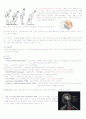 파킨슨 병 케이스 스터디 (parkinson`s disease case study) 4페이지