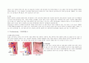 [간호학]Hypopharynx cancer문헌고찰 3페이지