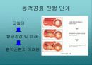 당뇨병과 합병증 관리PPT 15페이지