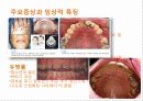 폭식증[addephagia 暴食症 신경성 폭식증]  3페이지