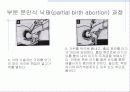 낙태 (落胎, abortion) 8페이지