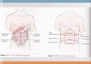 Epigastric pain 원인 18페이지