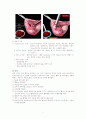 자궁외임신 모성 케이스 레포트 7페이지
