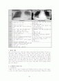 소아폐렴 모성간호학 케이스 스터디 21페이지