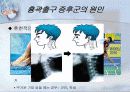 흉곽출구증후군 6페이지