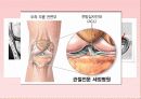 한국무용 연습 시 발생되는 슬관절 상해에 관한 연구, 연구 필요성 목적, 방법, 제한점 6페이지