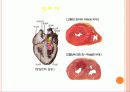 작업관련 뇌•심혈관, 그 예방대책은 무엇인가? 21페이지