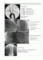 2교시  방사선 영상학 & 3교시  - 심혈관조영술 2페이지
