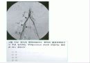 중재적 시술 55페이지