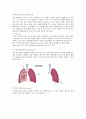 폐암(Lung cancer)환자의 간호과정 10페이지