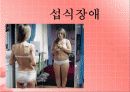 섭식장애의 개념과 원인 및 섭식장애 치료방안 [A+추천 레포트] 1페이지