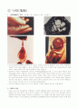 [성심리학] 임신과정, 수유, 피임, 낙태에 대한 모든 것 (2012년 추천 우수) 20페이지