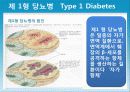 성인질환과 운동처방 - 당뇨병diabetes 26페이지