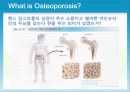 성인질환과 운동처방 - 골다공증osteoporosis 4페이지