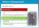 성인질환과 운동처방 - 골다공증osteoporosis 5페이지