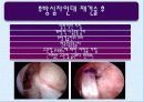 후방십자인대 및 내측측부인대 손상 13페이지