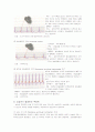 심전도 기본 - 부정맥의 이해 11페이지