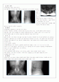 Case_Study_척추협착증 6페이지