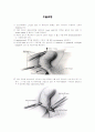 수술실 실습 복강경 담낭 절제술 Laparoscopic Cholecystectomy(LC) 2페이지