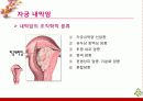 부인암 - 자궁경부암, 자궁내막암, 난소암, 질암 15페이지