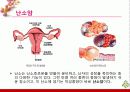 부인암 - 자궁경부암, 자궁내막암, 난소암, 질암 22페이지