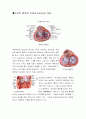 SICU질환명, 주요검사, 약, 의학용어 ( 승모판 협착증,폐색전증,담낭염)  1페이지