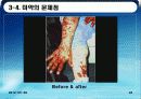 질병,범죄,에이즈,마약,전쟁,인간,피해사례 47페이지