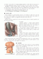 [성인간호학]_수술방_case_Laparoscopic_Cholecystectomy 2페이지