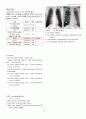 [성인간호학] 폐기흉 (Pneumothorax) 케이스 스터디 12페이지