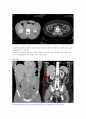 비만 17페이지