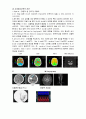 뇌경색 case study  5페이지