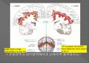 신경계검사 (Neurological examination) 6페이지