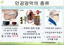 [생명공학개론] 인공장기 28페이지