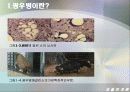 [생물학개론] 광우병관련 mcd (Mad Cow Disease) 9페이지