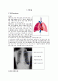 기흉컨퍼런스 1페이지