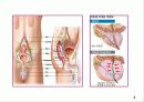 전립선비대증 4페이지