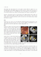 [성인간호]GS병동-위암케이스(stomach cancer casestudy) 6페이지