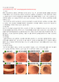 내시경 요법 (진단적 내시경, 치료내시경 전부) 2페이지