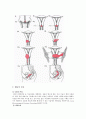 [모성간호학-환자사례 간호과정] 자궁경부 이형성증 (moderate cervical dysplasia) 케이스 23페이지