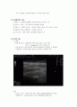 ★ 충수돌기염 케이스 스터디 (appendicitis Case Study) 4페이지