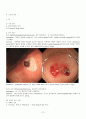 Upper gastrointestinal hemorrhage(UGI bleeding, 상부위장관출혈) Case Study 12페이지