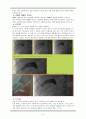 10A acute cholecytitis - case study 9페이지