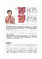 아동간호학 - 폐렴(pneumonia) & 인플루엔자 케이스 6페이지