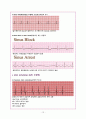 심전도 레포트 (Heart Anatomy & EKG report) 12페이지