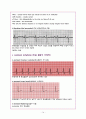 심전도 레포트 (Heart Anatomy & EKG report) 14페이지