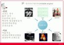 불안정성 협심증 사례연구.ppt 7페이지