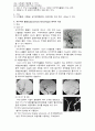 지주막하 출혈(SAH : subarachnoid hemorrhage) case study 6페이지