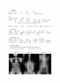 [간호학 임상 CASE] 척추측만증 (Scoliosis) 4페이지